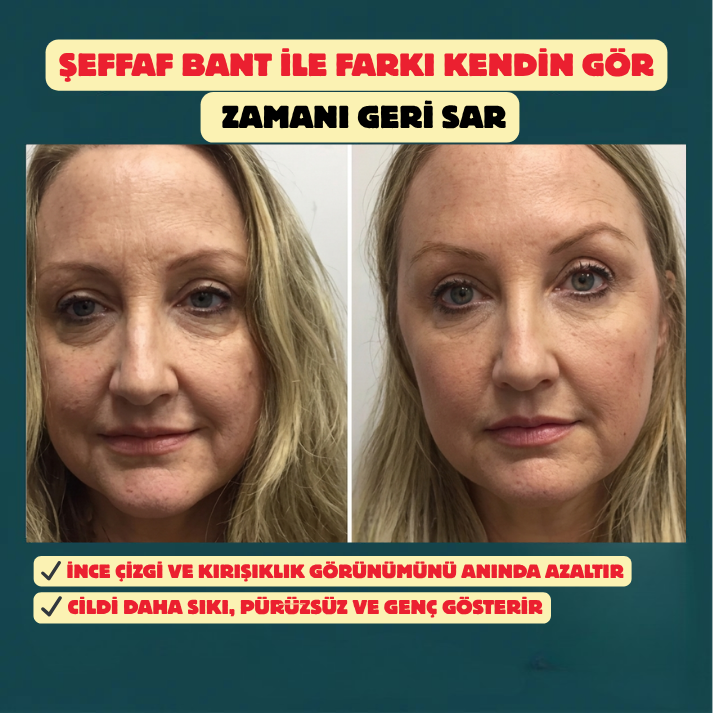 Doğal Botoks Etkili Şeffaf Bant(40 adet)