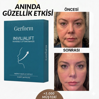 Doğal Botoks Etkili Şeffaf Bant(40 adet)